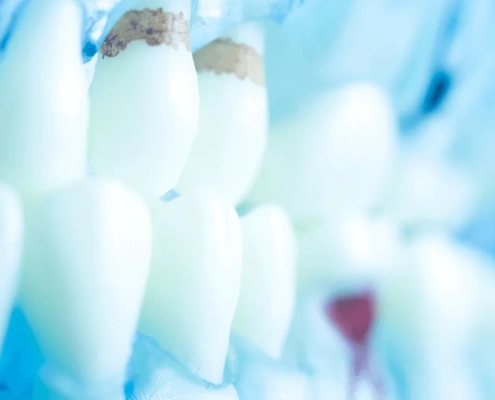 Oaks Dental Group Oral Health Images